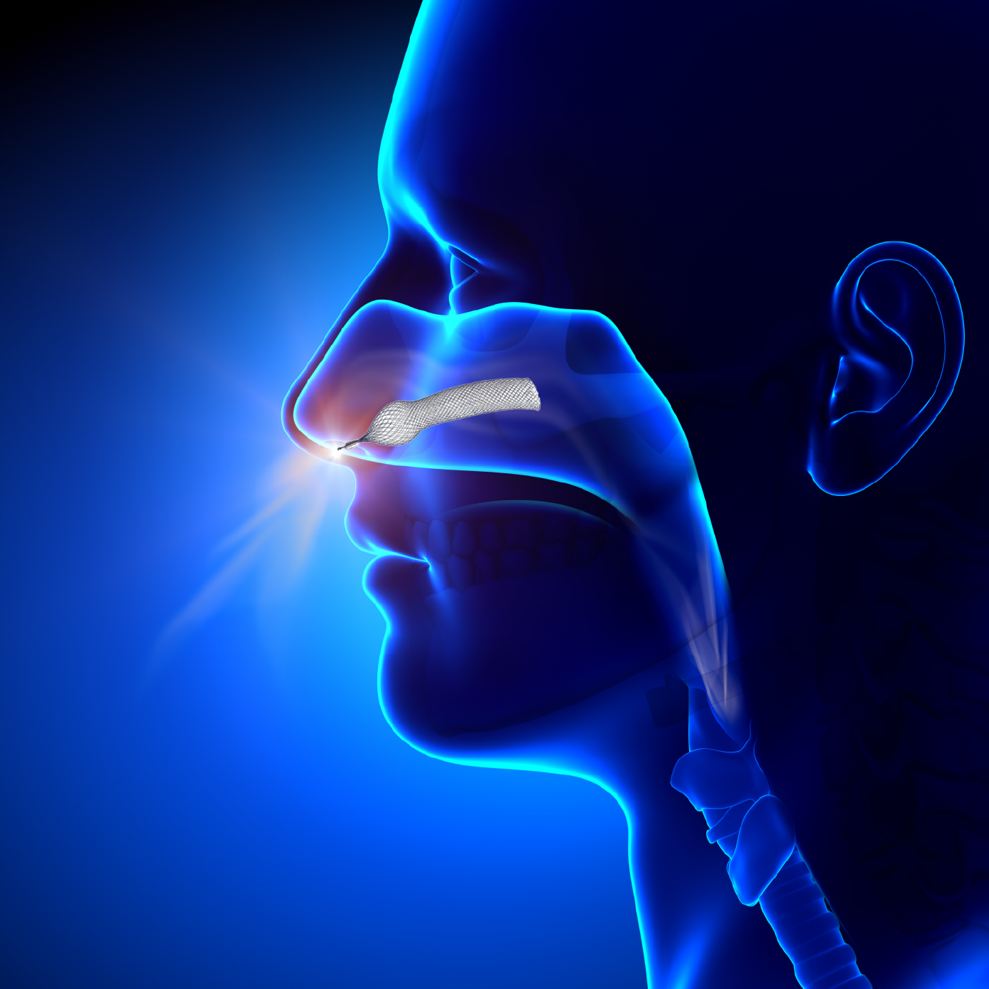 2 Inch Nasal Airway Stents - Image 2